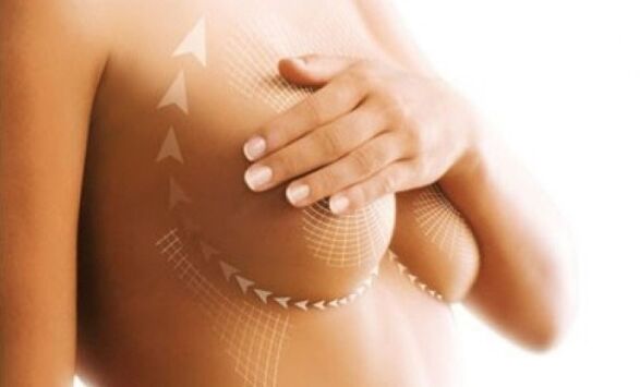Anheben der Naht zur Brustvergrößerung